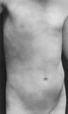 weston_torso_of_neil